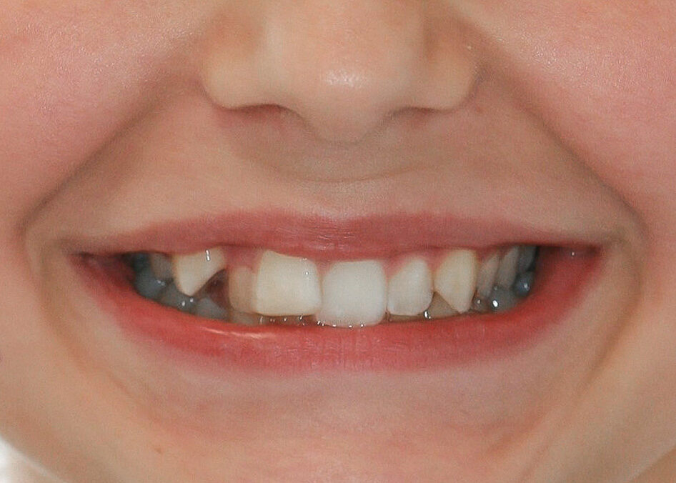 A1