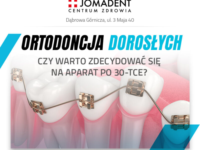 Ortodoncja dla dorosłych: Czy warto zdecydować się na aparat po 30-tce?
